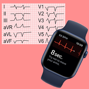 Montre Apple ECG